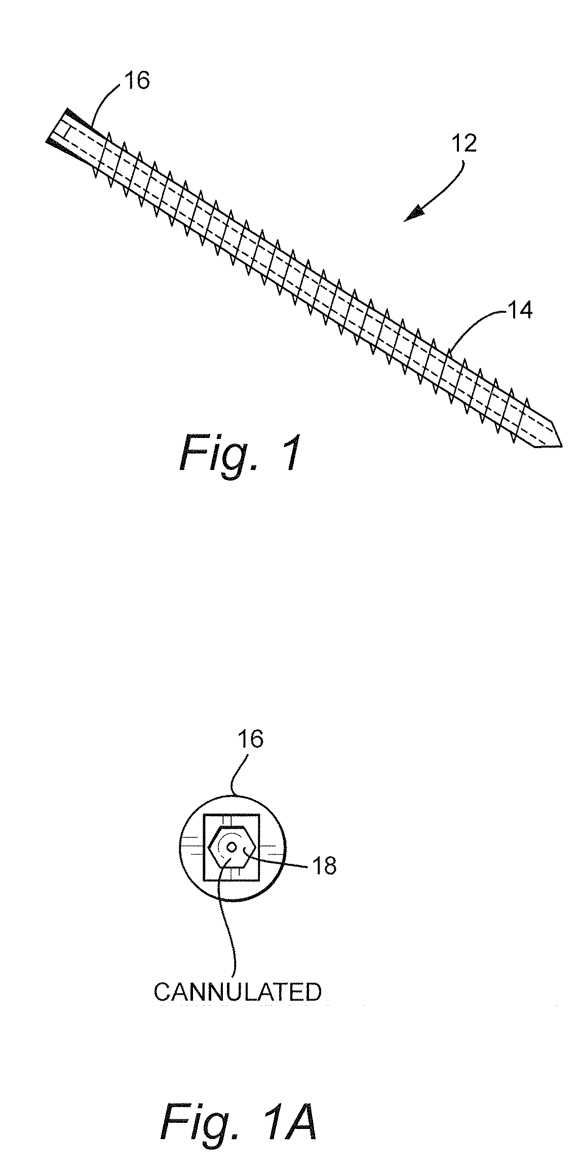 Transfacet-Pedicle Locking Screw Fixation of Lumbar Motion Segment