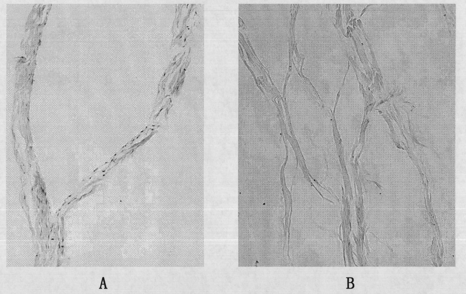 Acellular tendon or ligament collagenous fiber material and preparation method thereof