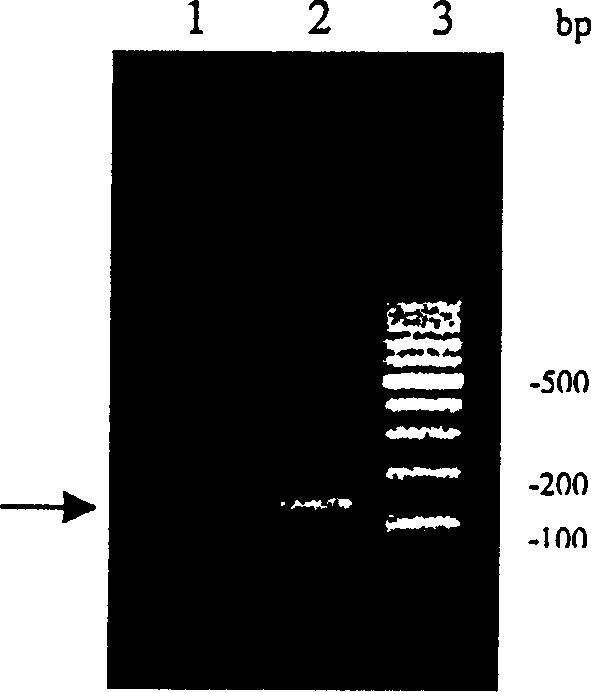 Cloning, Expression and bioactivity of new actinion toxin