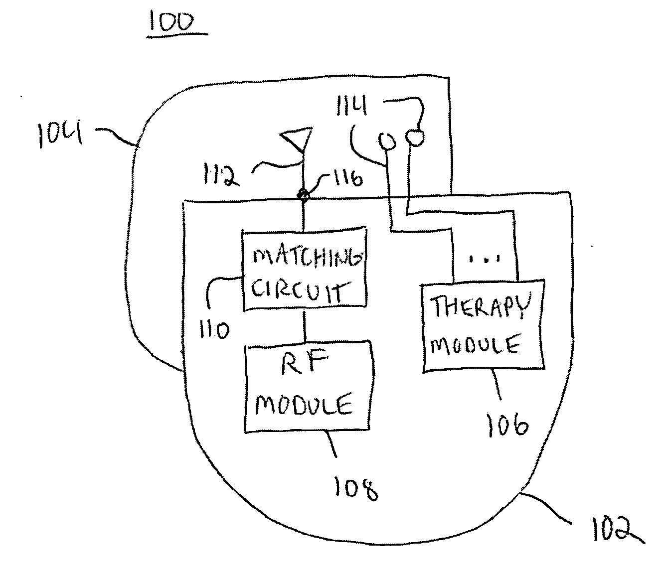 Telemetry antennas for implantable medical devices