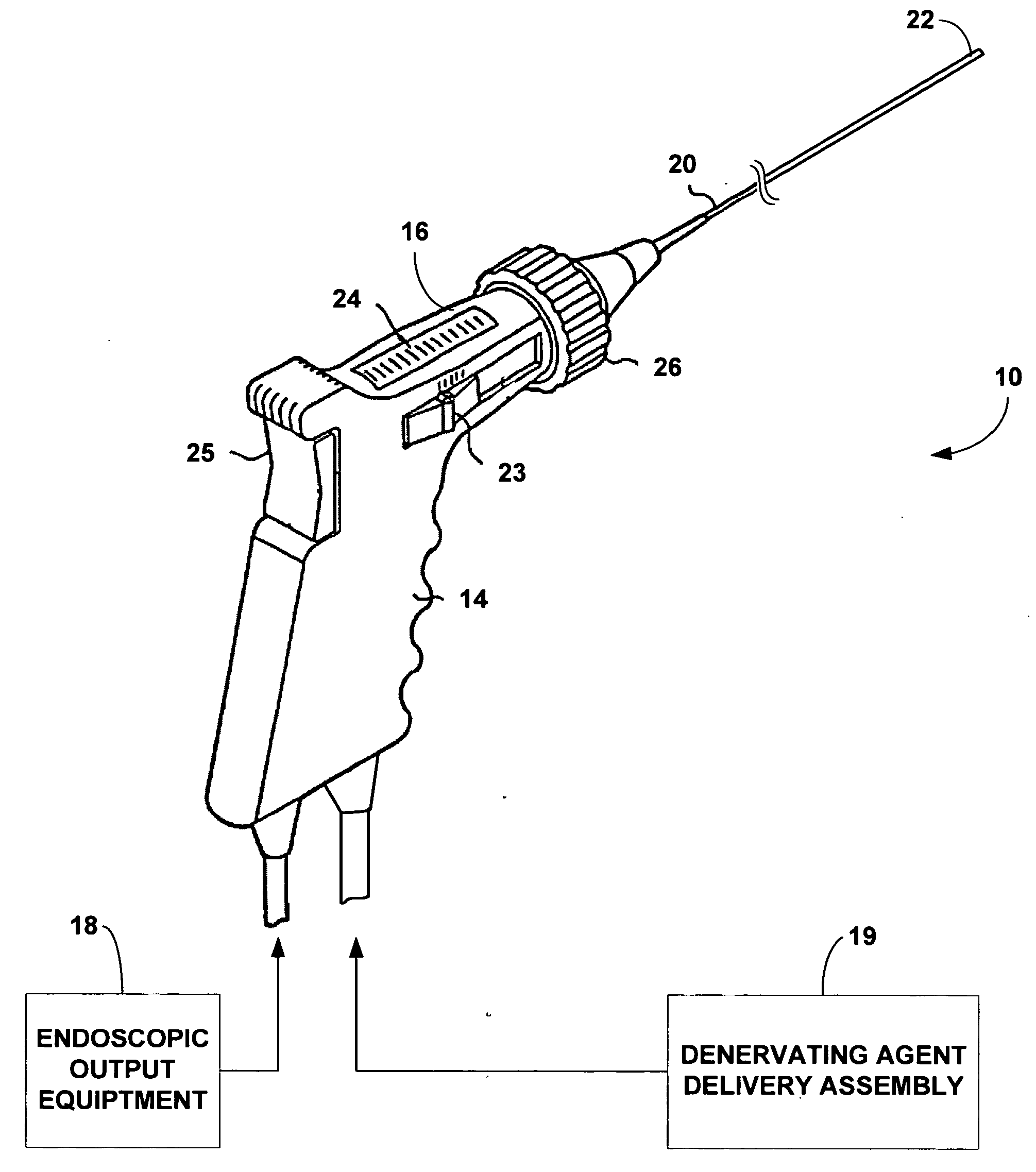 Techniques for transurethral delivery of a denervating agent to the prostate gland