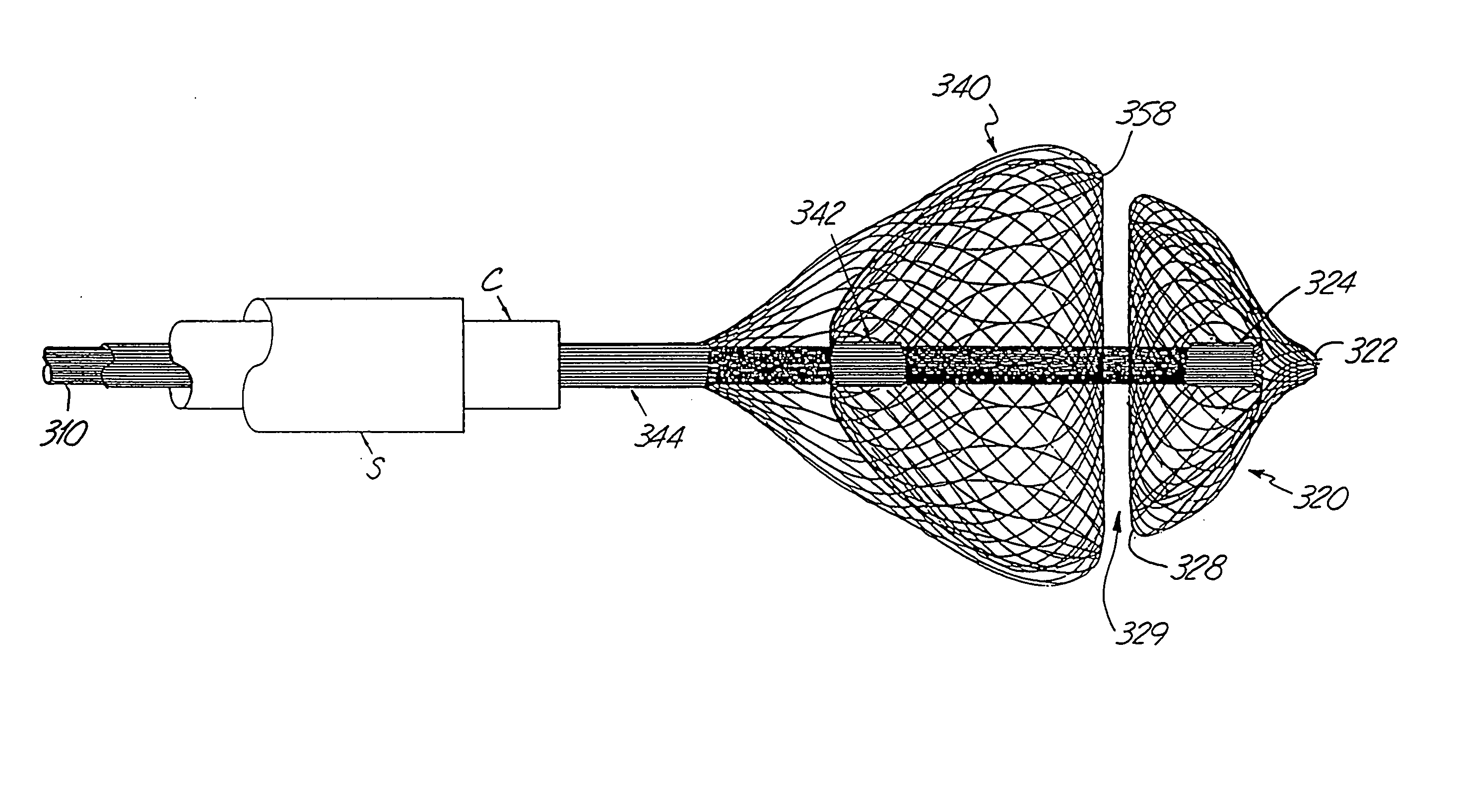 Method and device for filtering body fluid