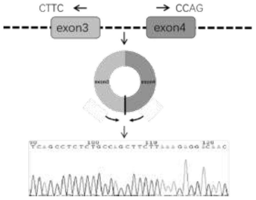 Biomarker for nasopharyngeal carcinoma metastasis diagnosis and/or prognosis evaluation