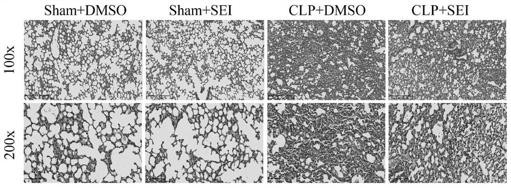 Application of senkyunolide I in sepsis lung injury treatment medicine