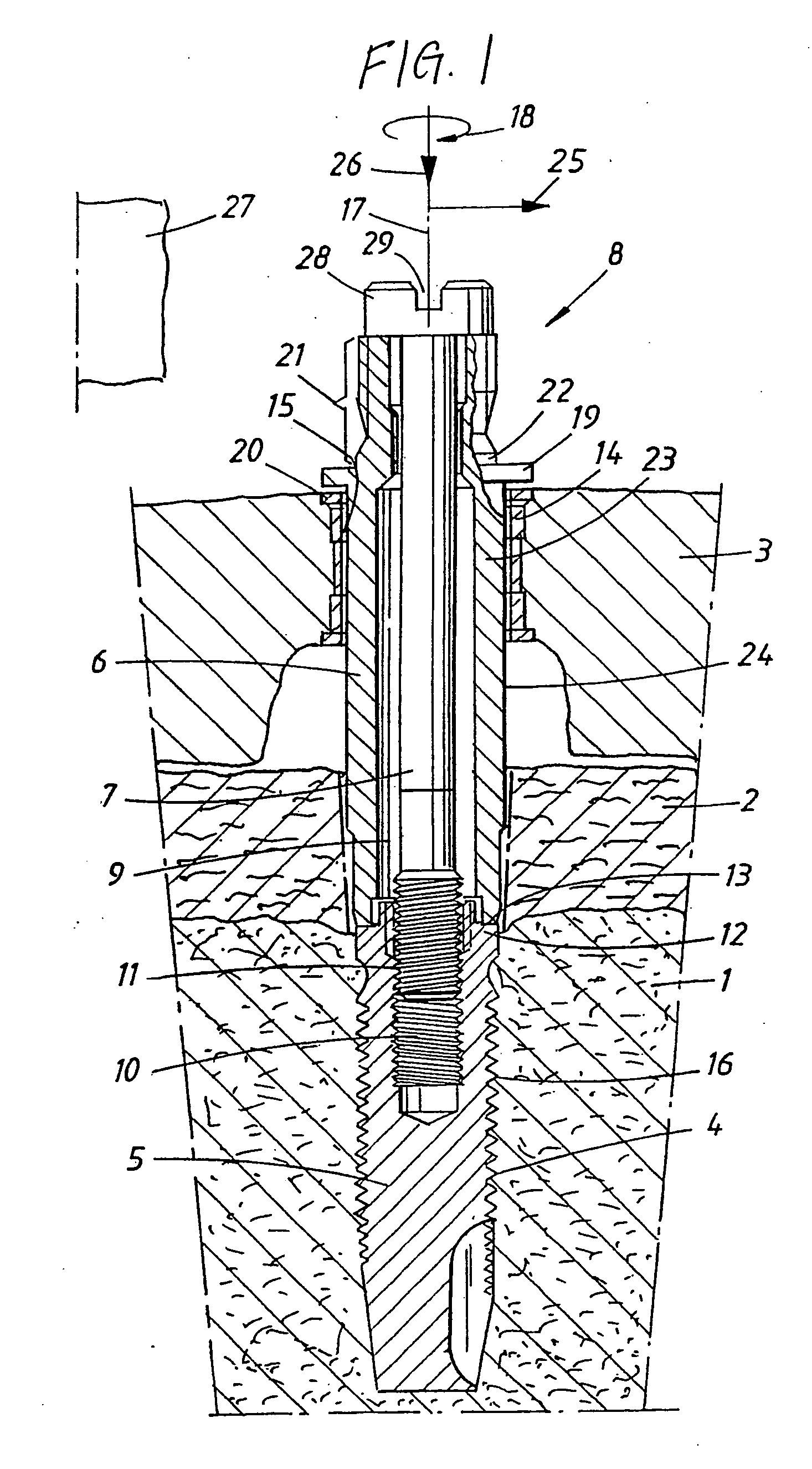 Device and arrangement for fixture installation