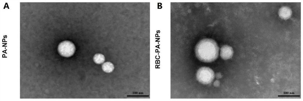 Novel kidney-targeted nano drug delivery system with biomimetic modification of erythrocyte membrane as well as preparation method and application of novel kidney-targeted nano drug delivery system