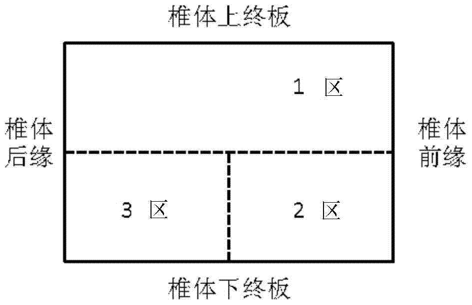 Spinal puncture guide needle