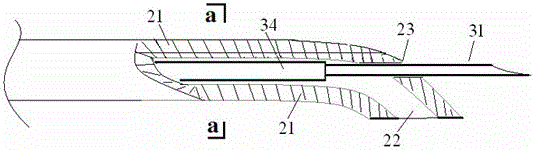 Dual-channel acoustic-guided epidural puncture needle