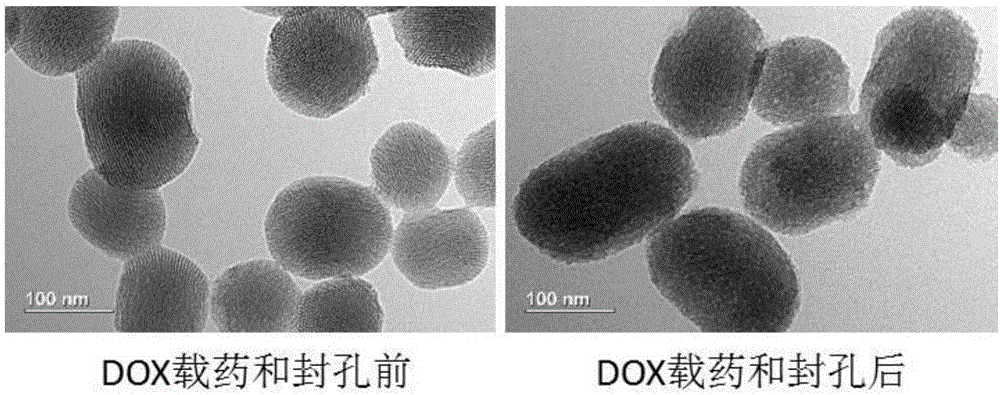 Preparation method of pH-sensitive drug-self-gating mesoporous nano antitumor carrier