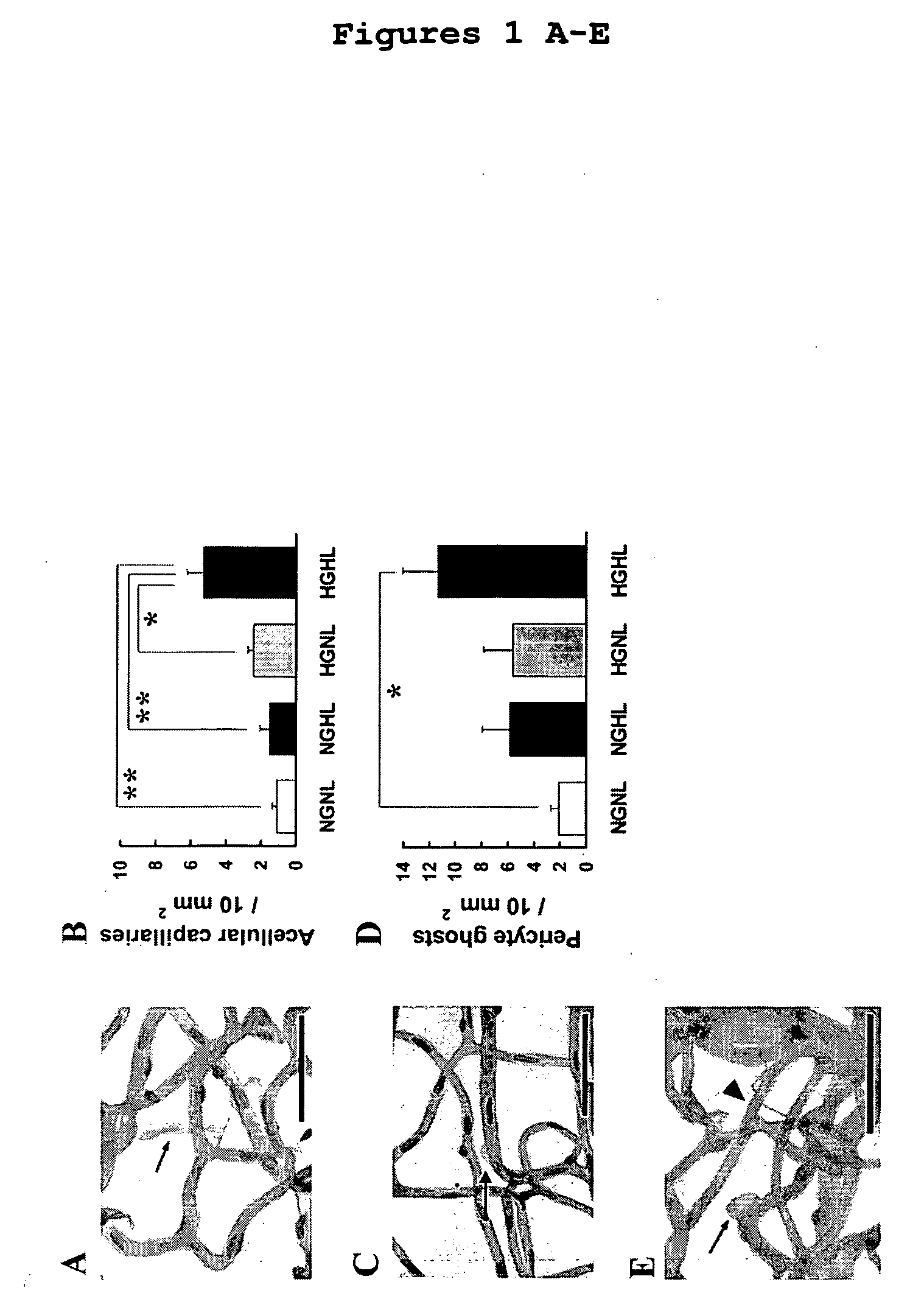 Rage-related methods for treating and preventing diabetic retinopathy