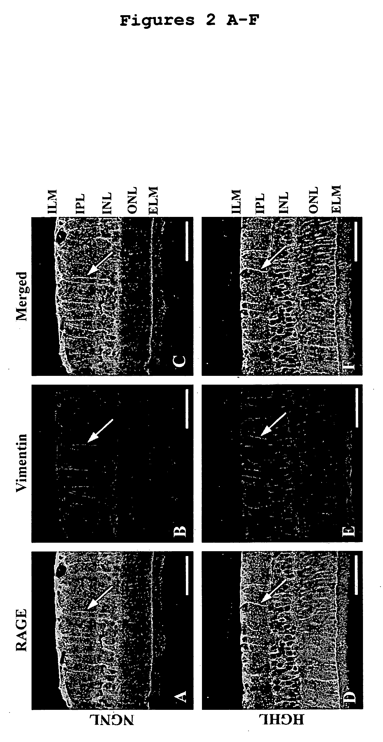 Rage-related methods for treating and preventing diabetic retinopathy