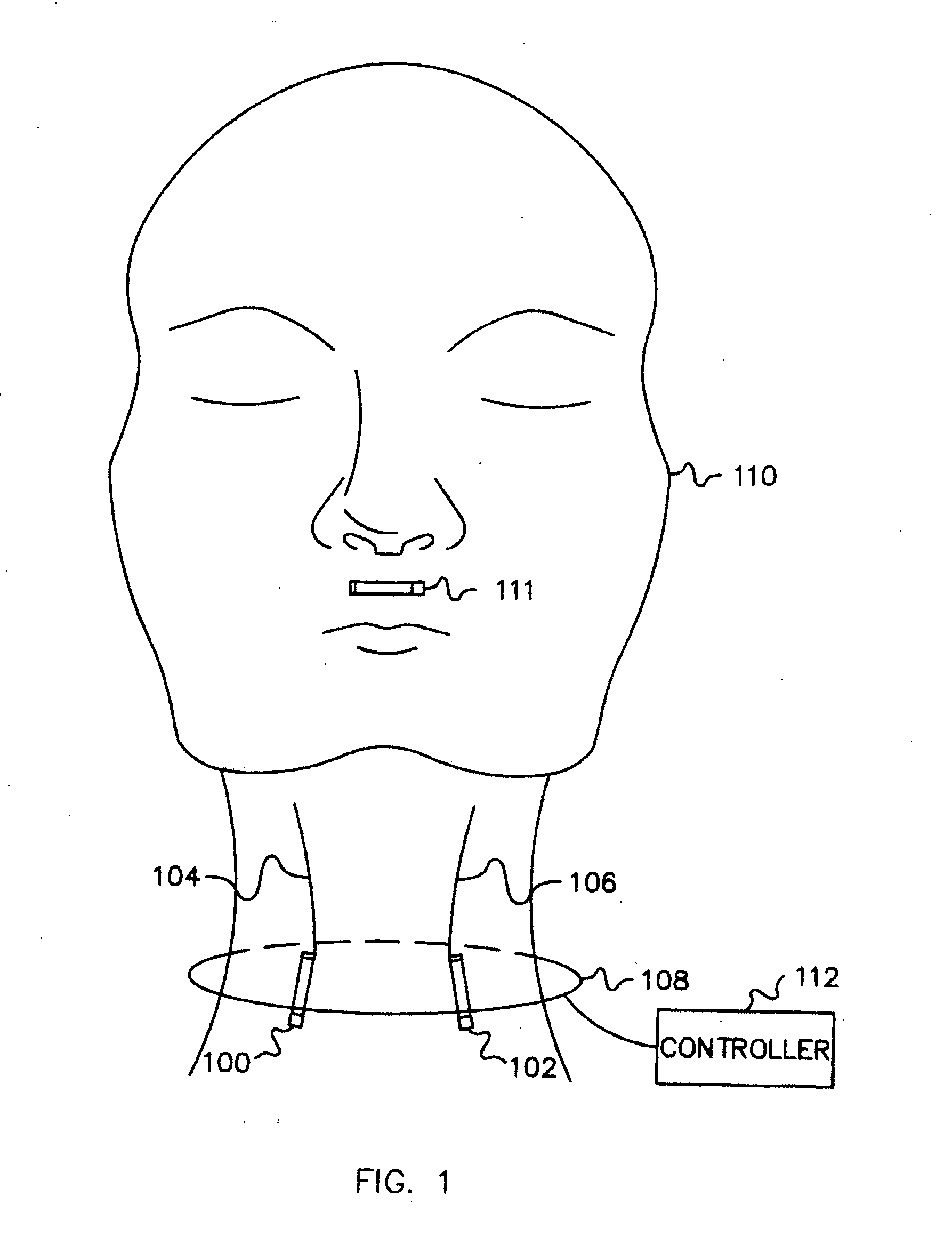 Method and system for treating sleep apnea