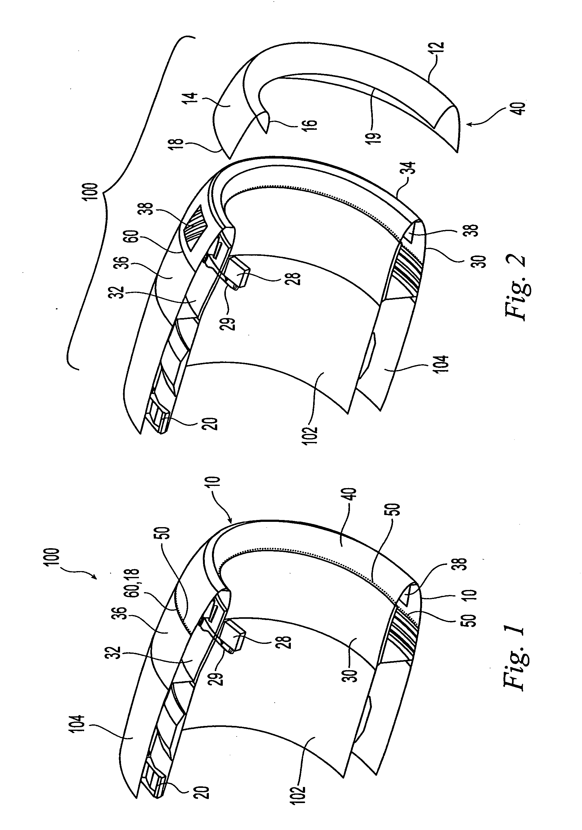 Aircraft engine nacelle inlet having access opening for electrical ice protection system