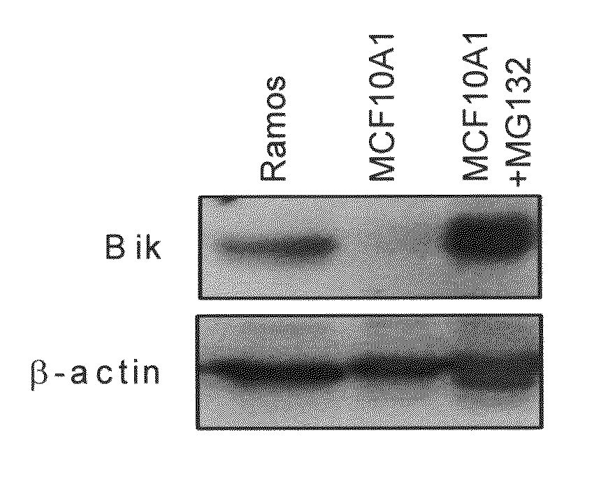 Apoptotic pathway targeting for the diagnosis and treatment of cancer