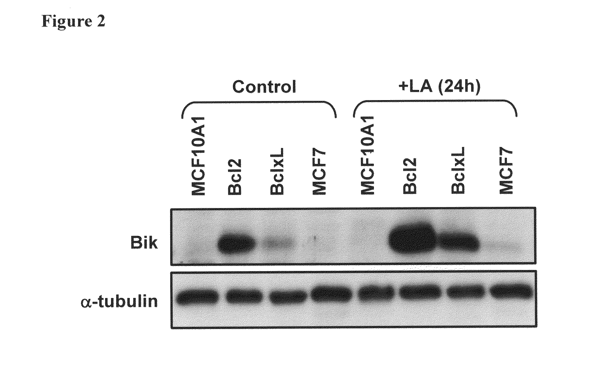 Apoptotic pathway targeting for the diagnosis and treatment of cancer