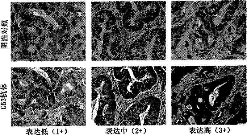 Method and reagent kit for forecasting outbreak age of carcinoma of colon