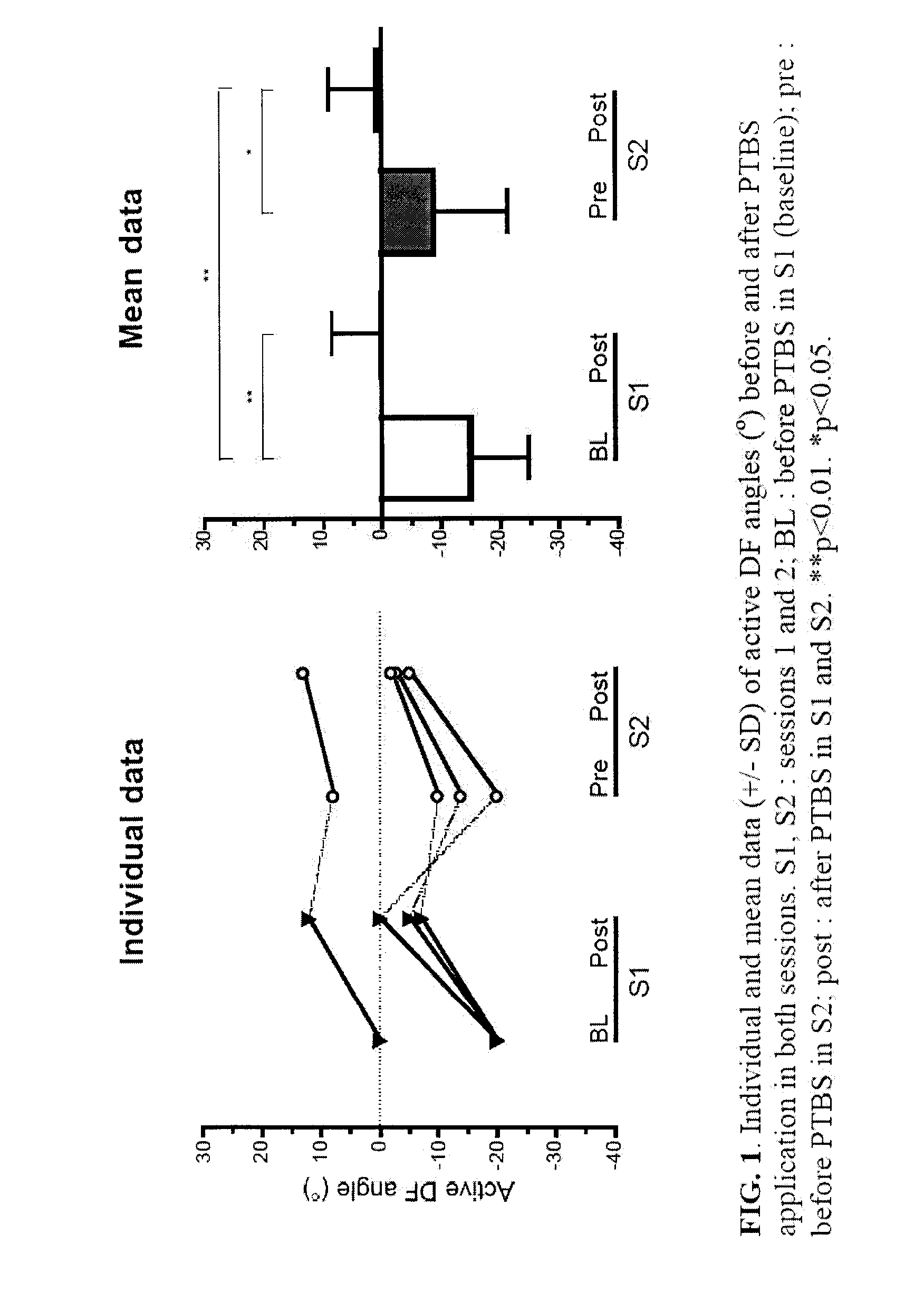 Method and Use of Peripheral Theta-Burst Stimulation (PTBS) for Improving Motor Impairment