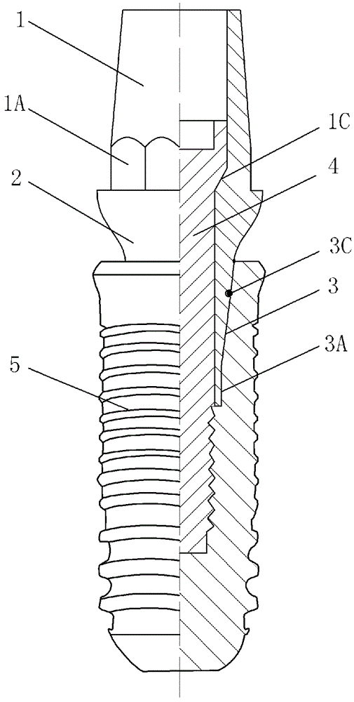 Hollow abutment capable of connecting with interior of dental implant