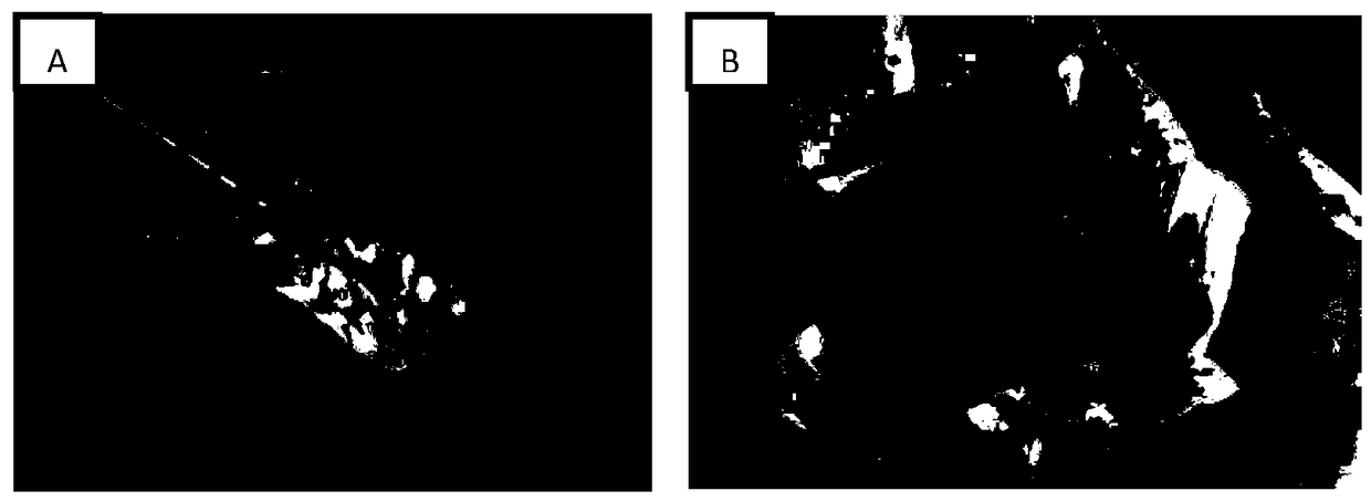 Cerebral cortex structure, cerebral blood vessel, intracerebral lesion 3D printing model and preparation method thereof