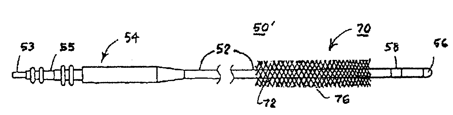 Systems and Methods for Implanting Tissue Stimulation Electrodes in the Pelvic Region