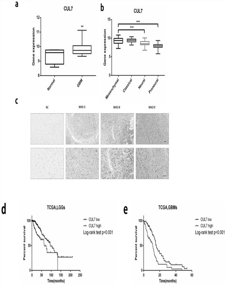 Application of cul7 in diagnosis, treatment and prognosis of glioma