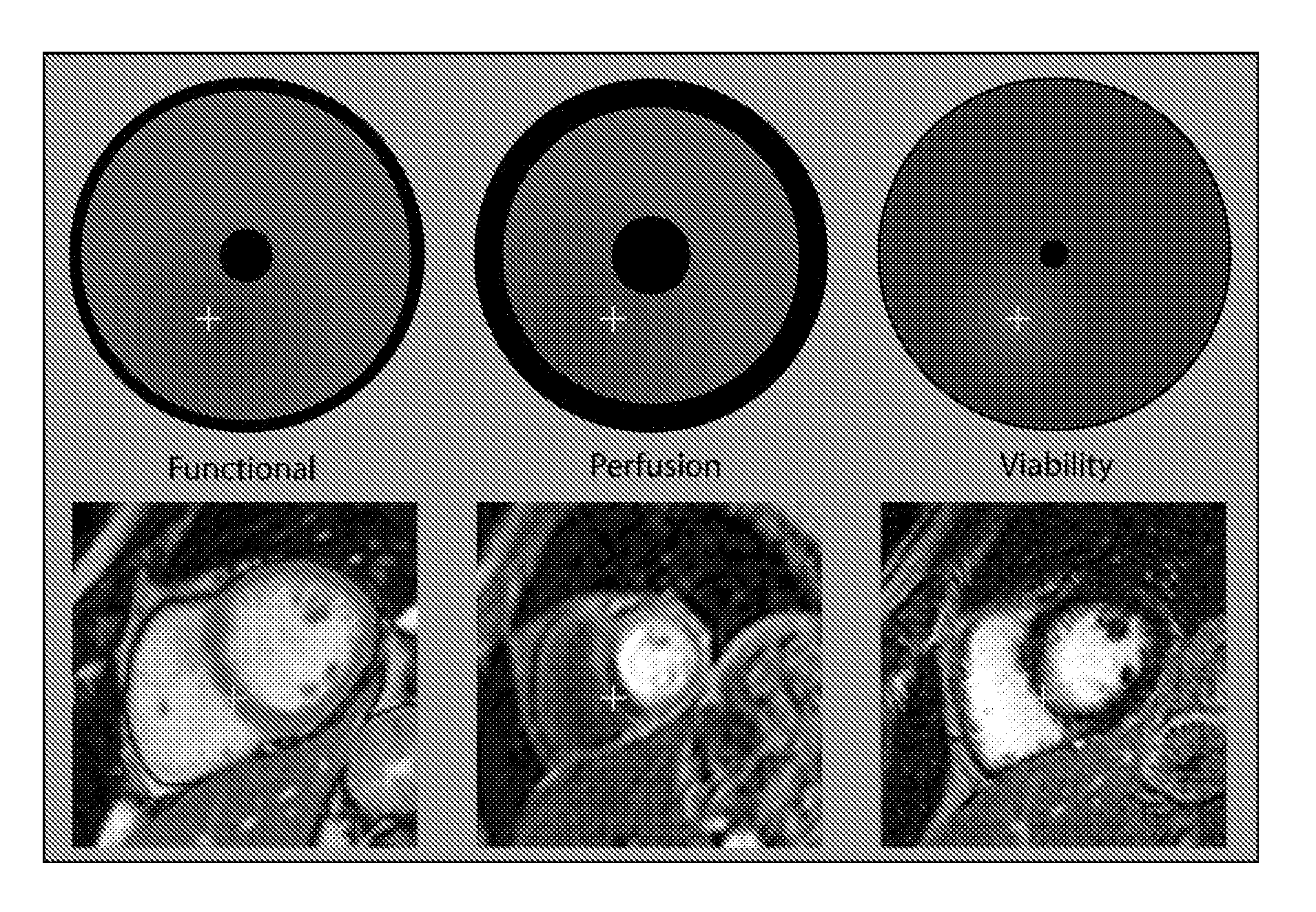 Reparametrized bull's eye plots