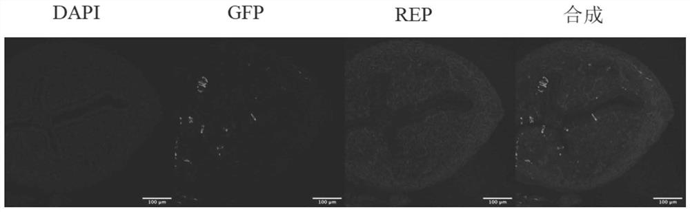 Construction and application of inducible uterine epithelium specific genetic engineering mouse