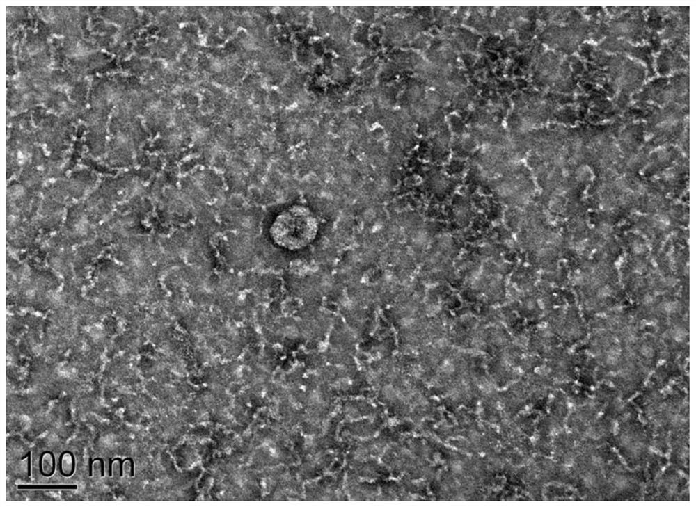 A seminal exosomal tsRNA marker associated with the diagnosis of non-obstructive azoospermia and its application