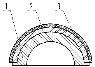 an acetabular cup