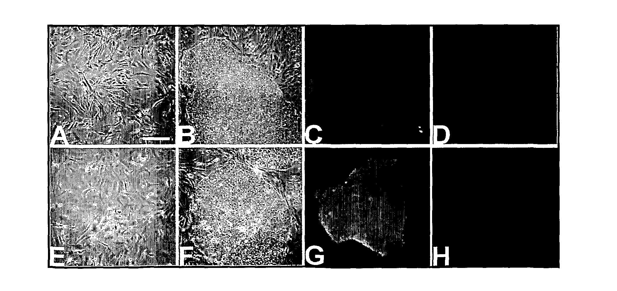 Feeder cell-free culture medium and system