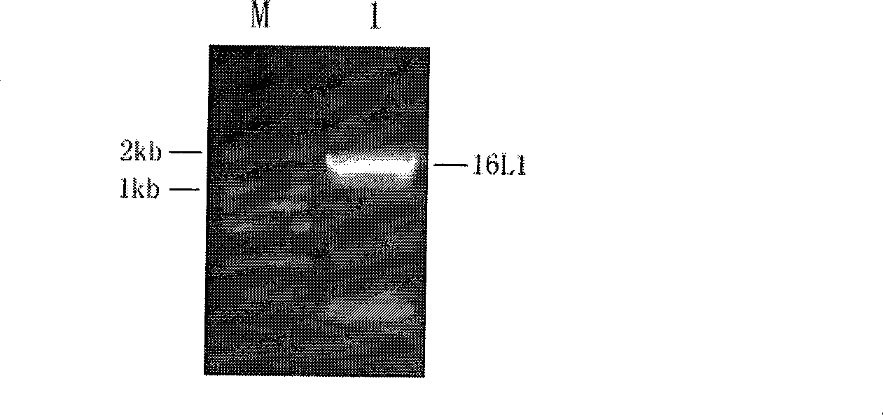 16 type human papilloma virus major capsid protein L1 gene