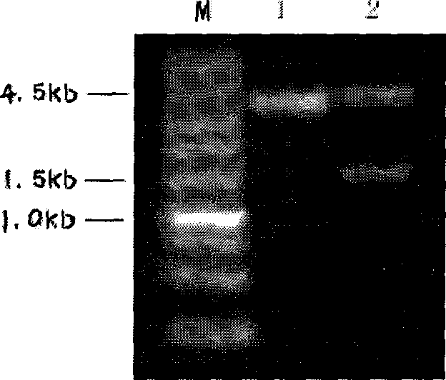 16 type human papilloma virus major capsid protein L1 gene