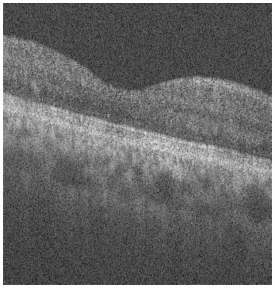 A Method for Retinal Layering in Fundus OCT Images