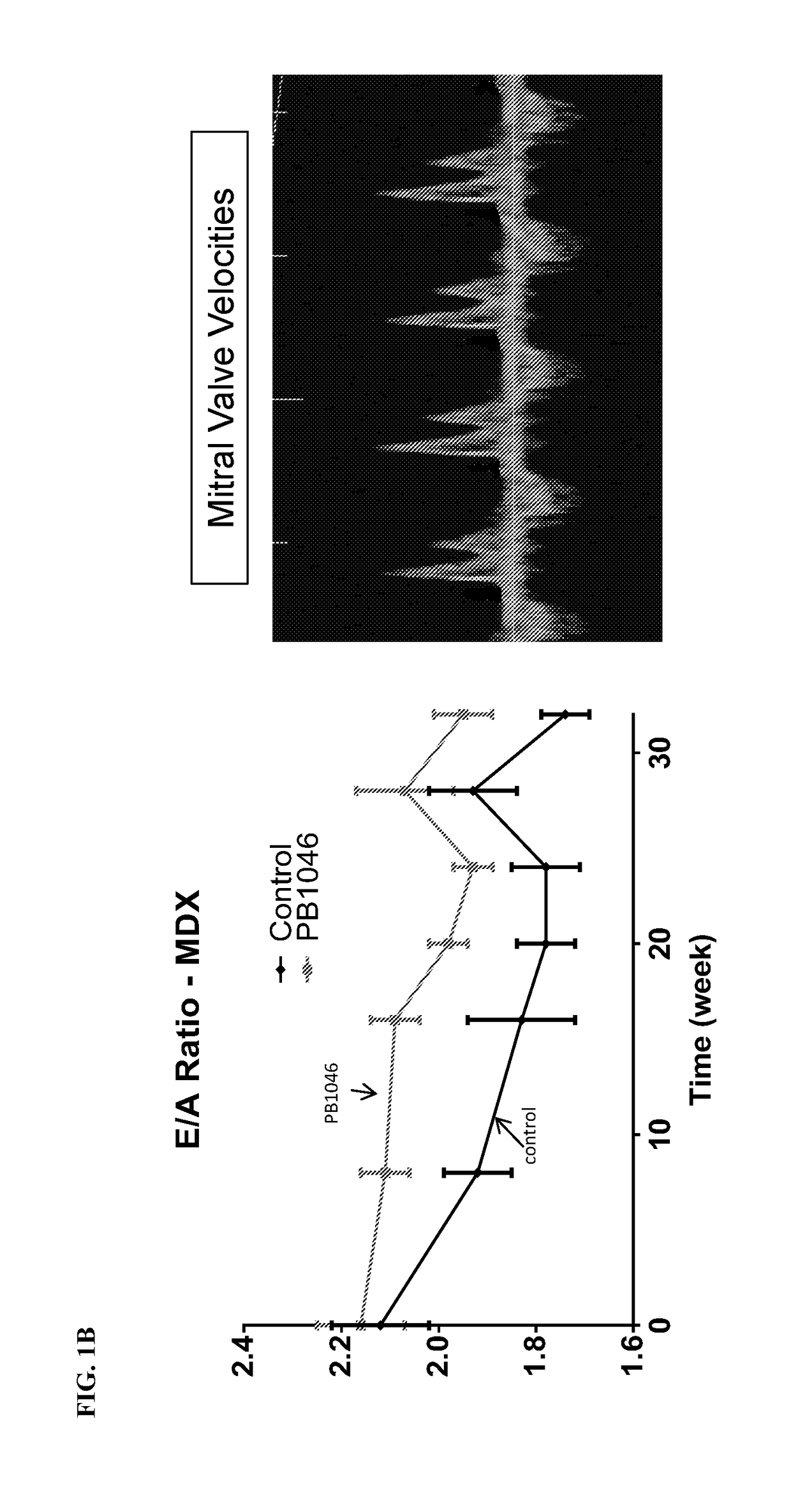 Methods and compositions for treating muscle disease and disorders