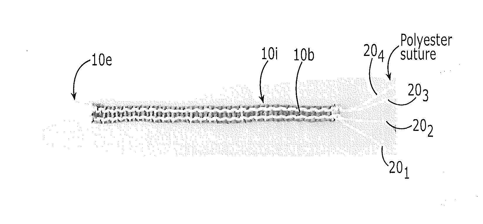 Collagen fiber ribbons with integrated fixation sutures and methods of making the same