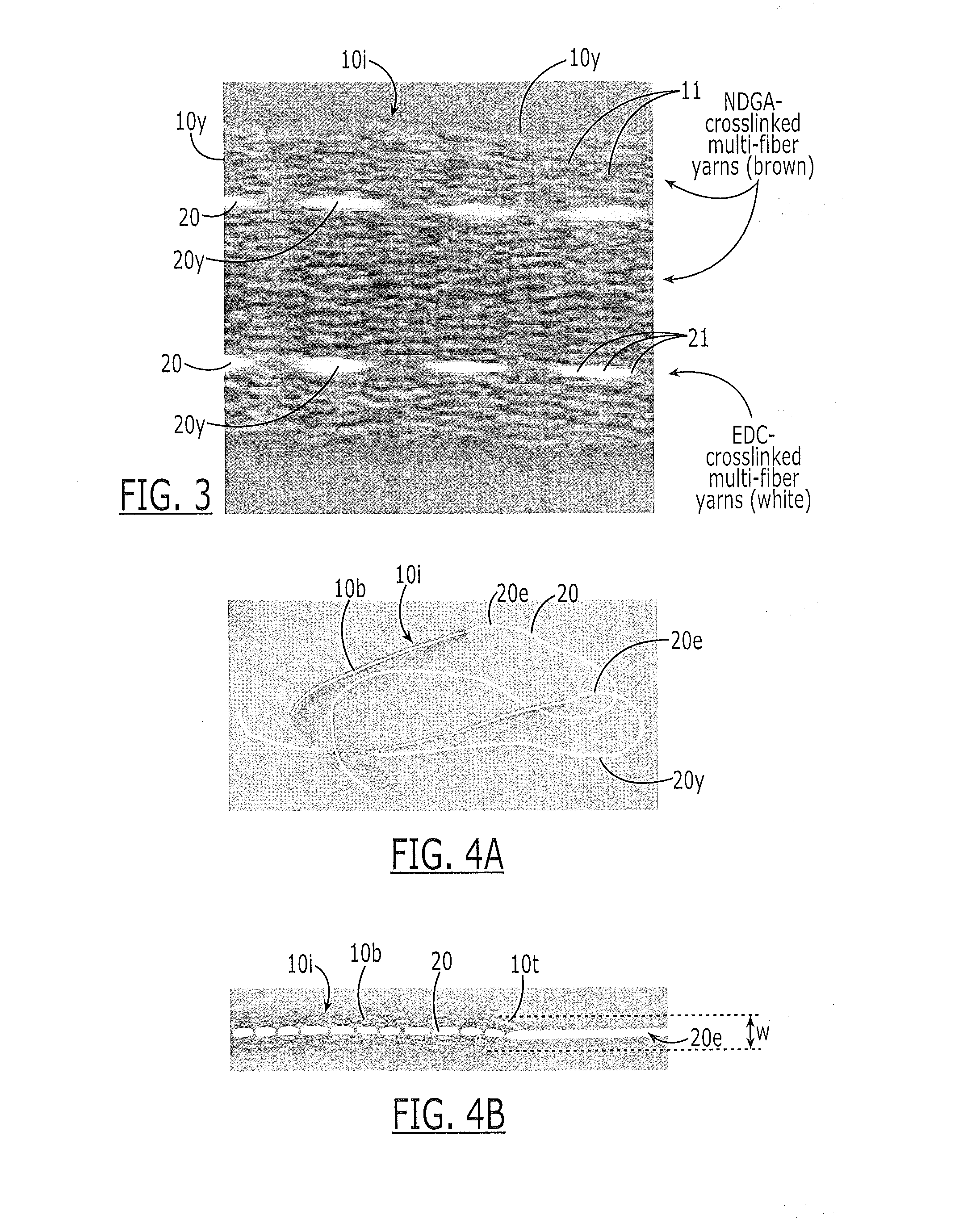 Collagen fiber ribbons with integrated fixation sutures and methods of making the same