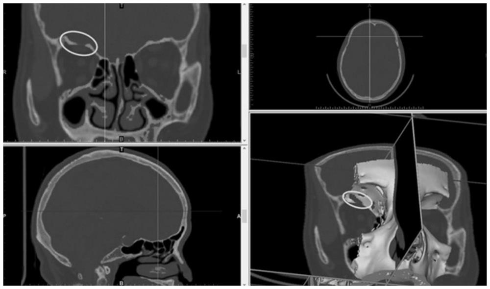 3D printing-based medical model and its manufacturing method