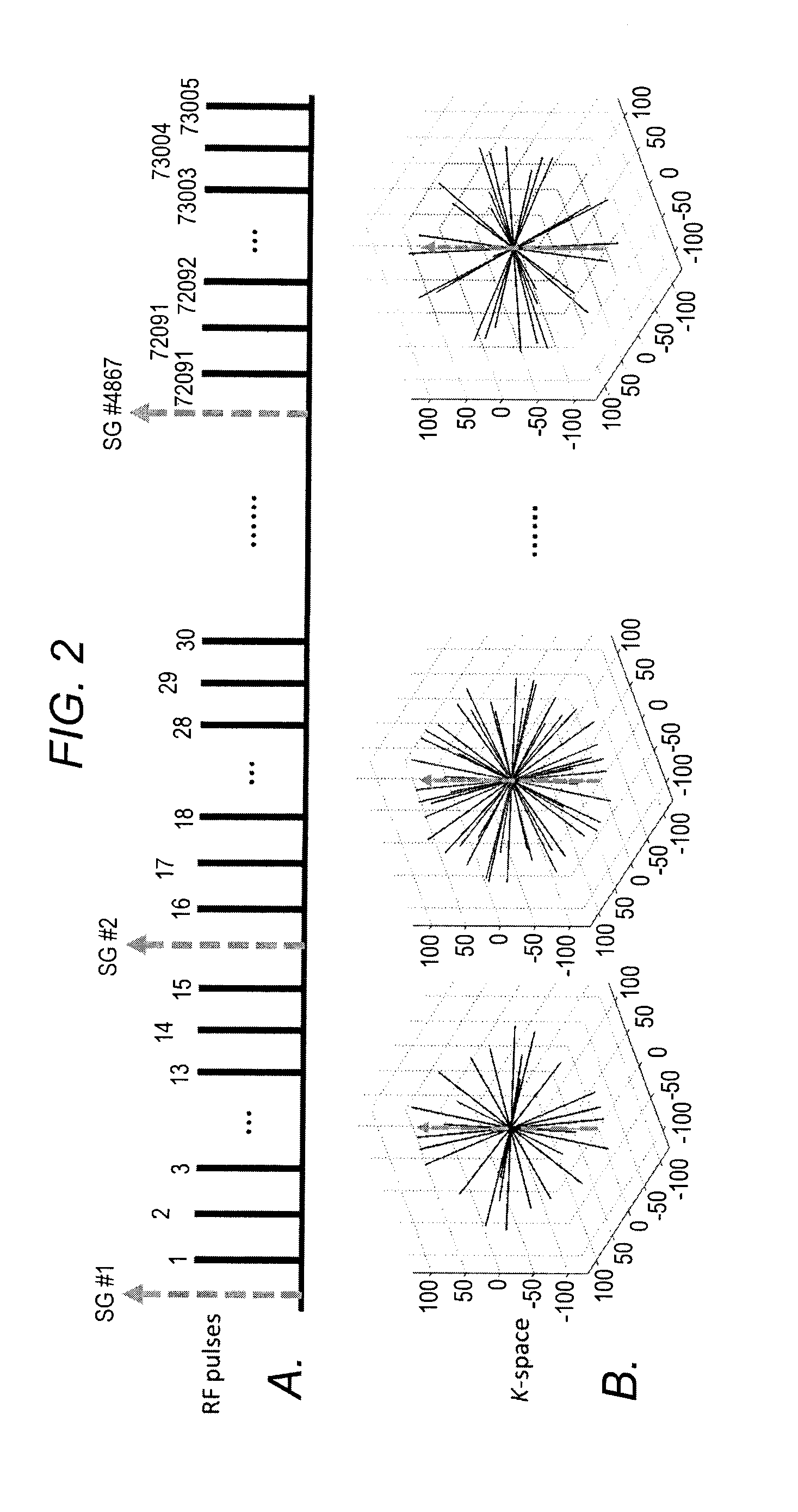 Characterization of respiratory motion in the abdomen using a 4d MRI technique with 3D radial sampling and respiratory self-gating