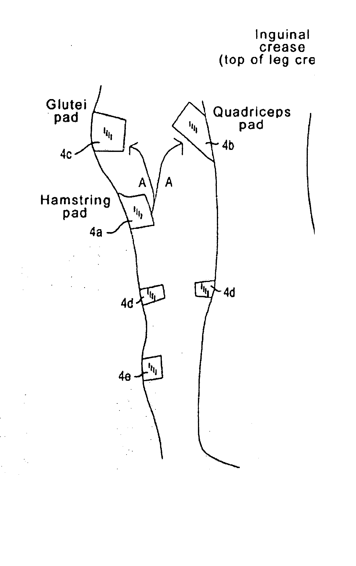 Apparatus for stimulating a muscle of a subject