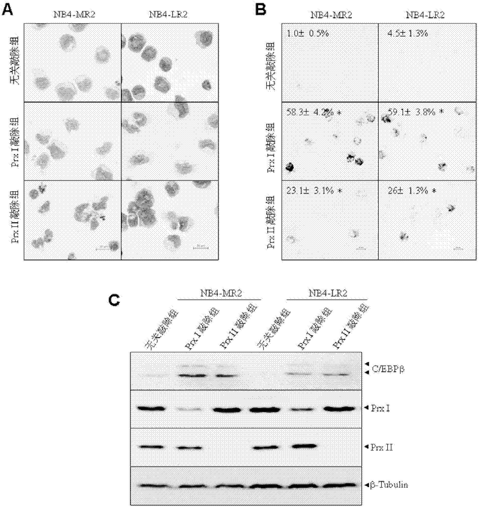 Medicament target for treating acute promyelocytic leukemia and inhibitor thereof