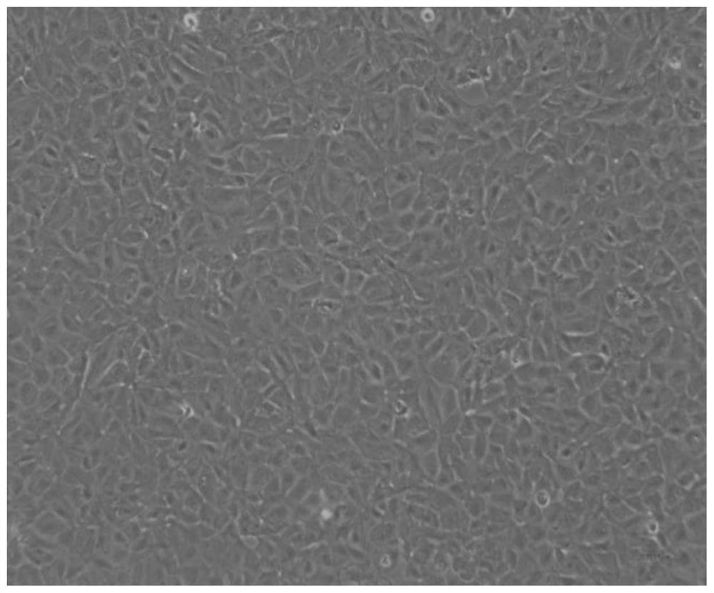 Establishment of carp brain cell line and its establishment method and application