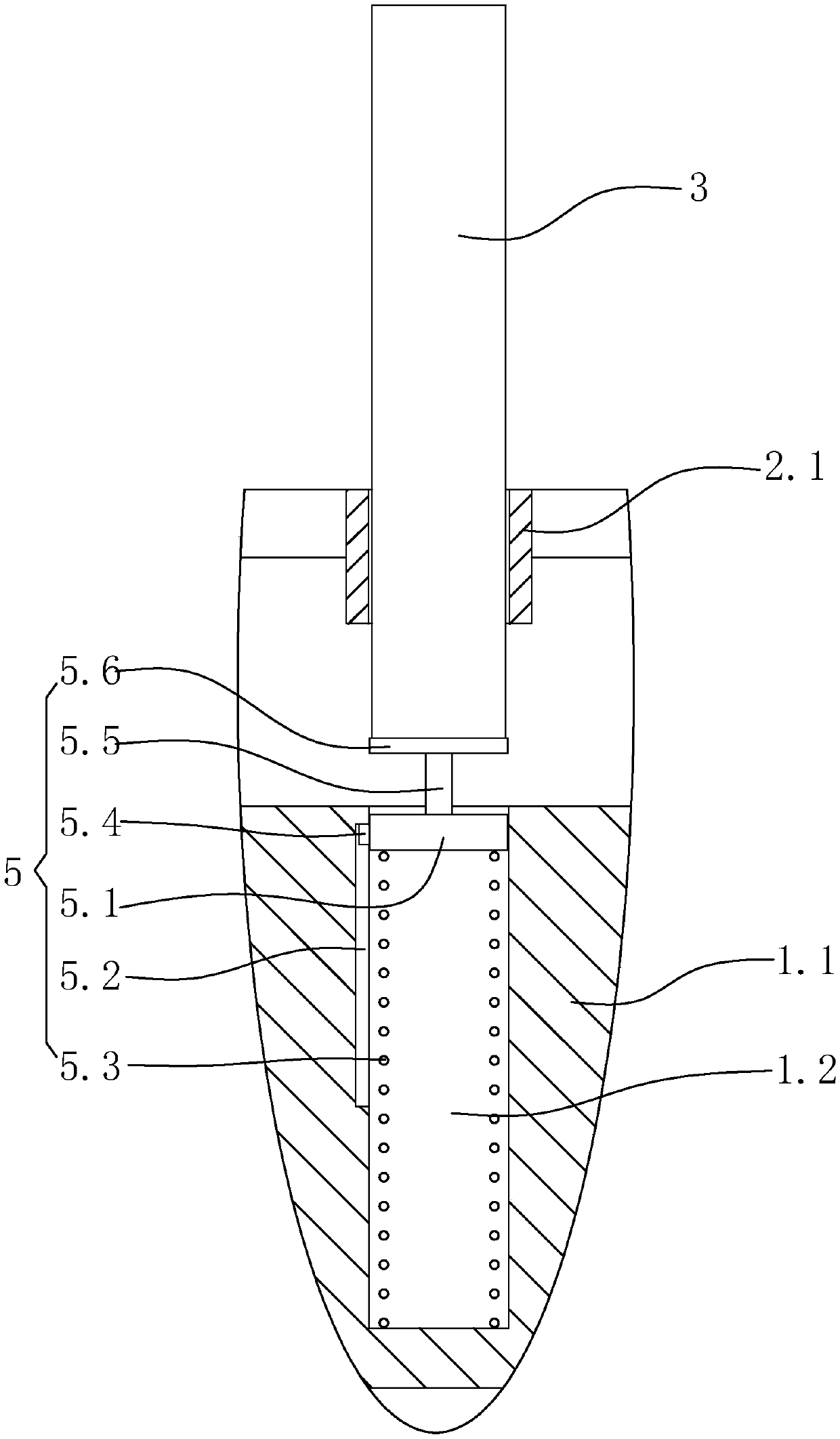 Acid removal device