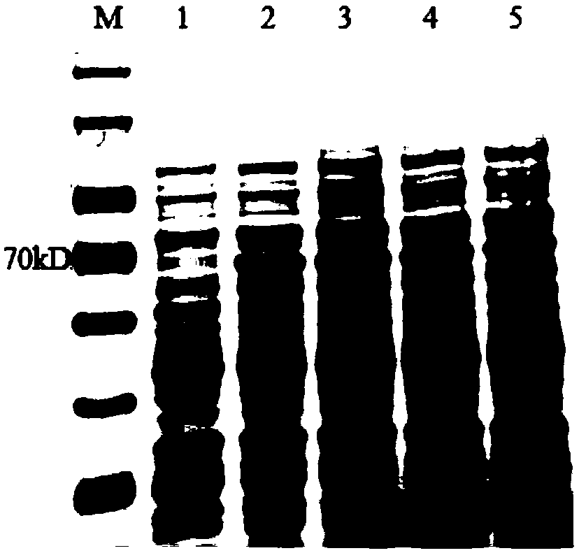 Monoclonal antibody to toxoplasma gondii ROP (rhoptry protein) 18, cell strain secreting monoclonal antibody and application thereof