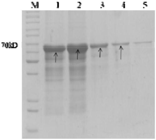 Monoclonal antibody to toxoplasma gondii ROP (rhoptry protein) 18, cell strain secreting monoclonal antibody and application thereof