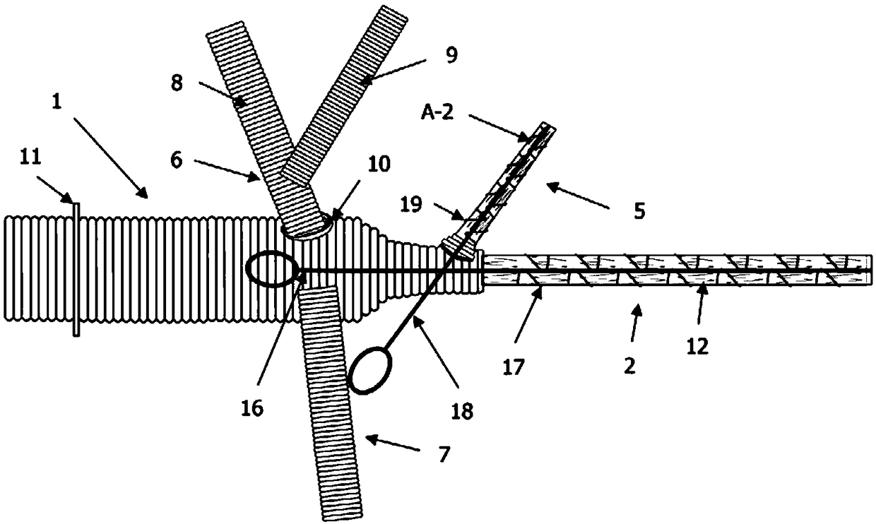 Individualized branch stent arch reconstruction artificial blood vessel