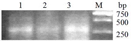 Recombinant transgenic vector carrying human insulin-like growth factor-I and use thereof