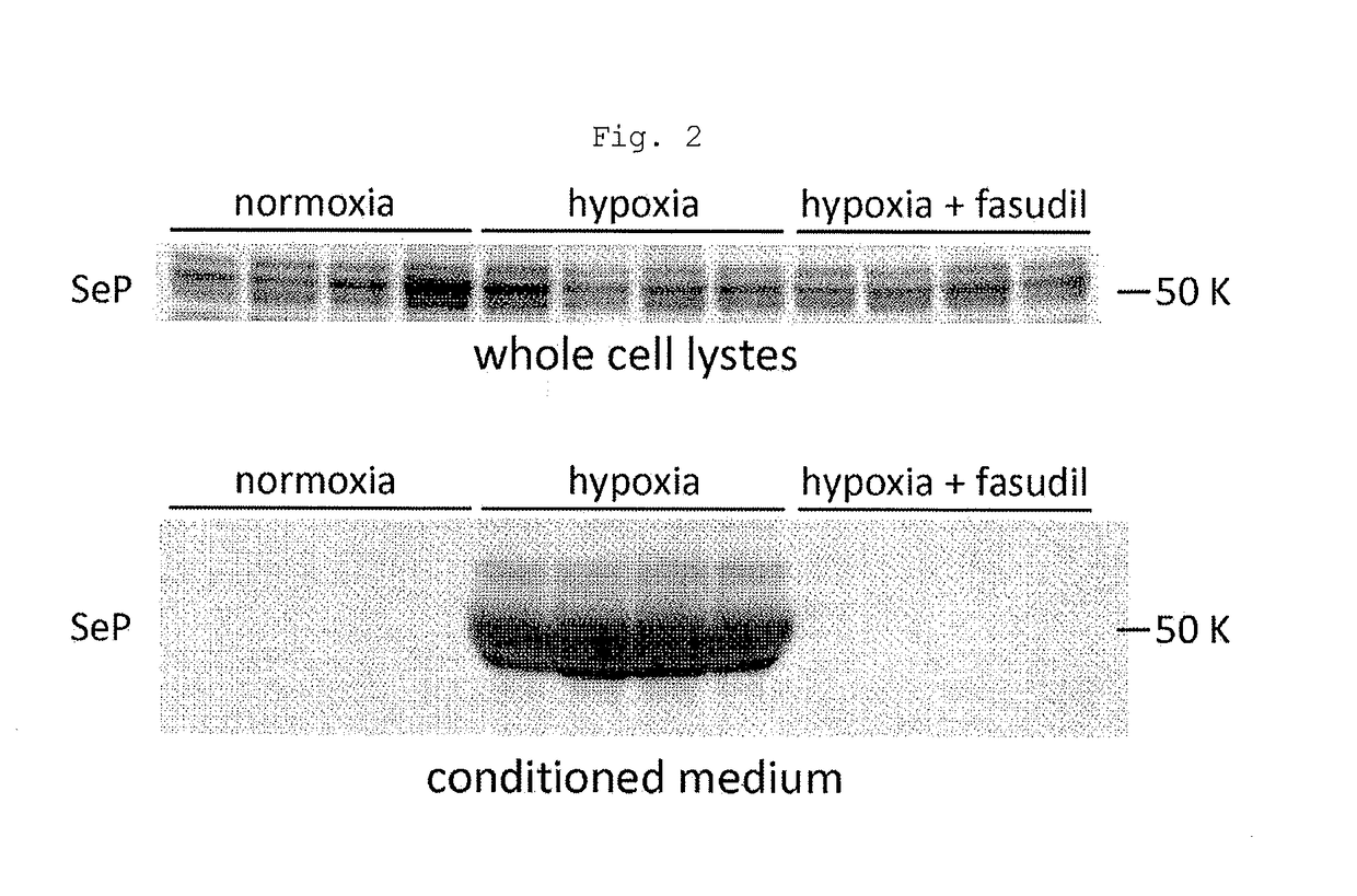 Method of testing for pulmonary hypertension