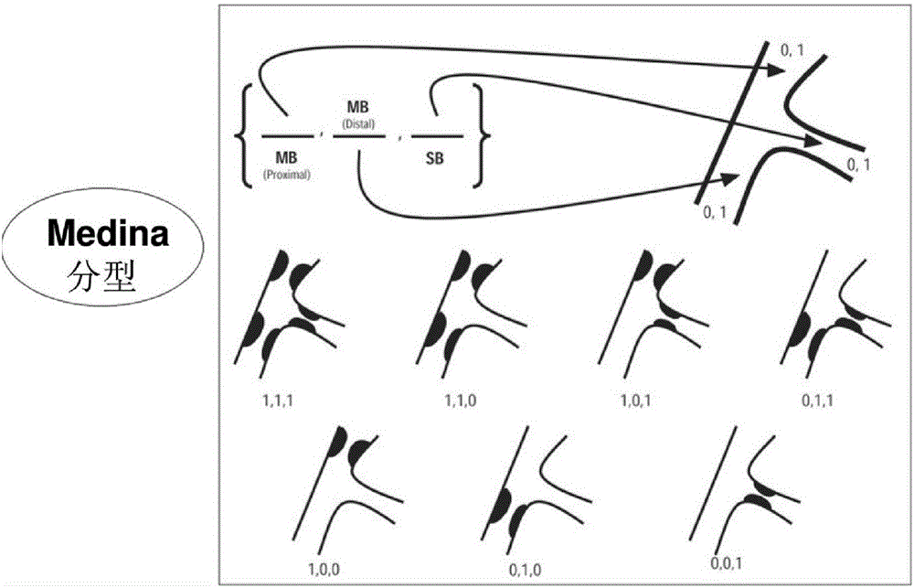 Coronary artery virtual stent implantation method and system based on haemodynamics analysis