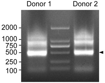 Method for constructing immune repertoire high-throughput sequencing library for removing chimera sequence in sample, group of primers and kit