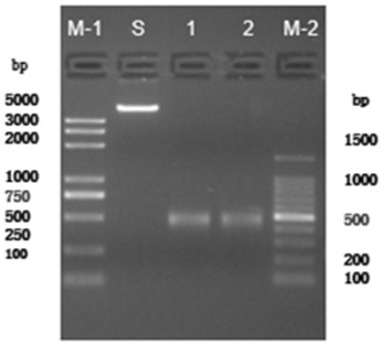 Method for constructing immune repertoire high-throughput sequencing library for removing chimera sequence in sample, group of primers and kit